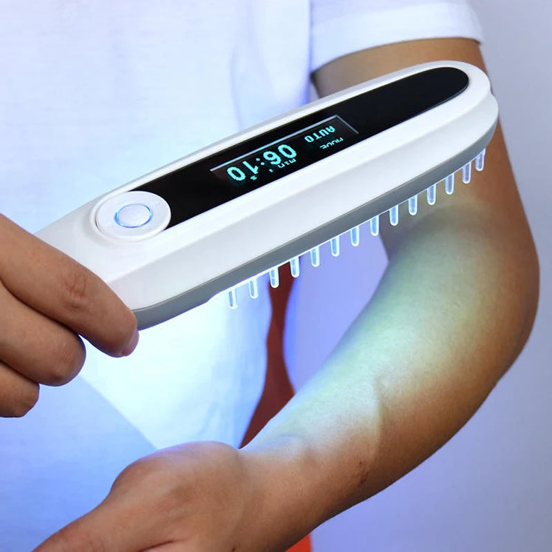 311NM UVB Narrow Band UV Light Source Treatment Vitiligo Psoriasis Eczema Therapy Lamp Ultraviolet Phototherapy Instrument