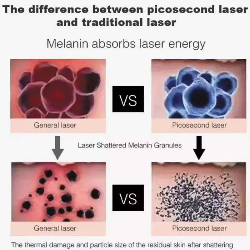 2025 New ND YAG Picosecond Laser Eyebrow Washing Freckle Remover Skin Rejuvenation Face Whitening Tattoo Cleaning Beauty Machine