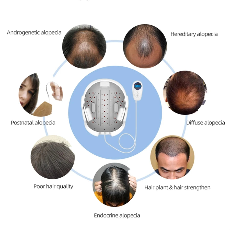 Lescolton Men Hair Growth Cap LLLT Helmet Laser Hair Regrowth Hair Loss Laser Treatment Hair Fast Growth Anti Hair Loss Device
