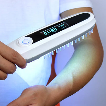 311NM  UVB Narrow Band UV Light Source Treatment Vitiligo Psoriasis Eczema Therapy Lamp Ultraviolet Phototherapy Instrument