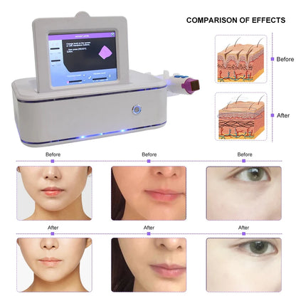 3 in 1 Skin Care Facial Lifting Fractional Skin Tightening Machine Tighten Beauty Tools Anti Aging Wrinkle Remover Device