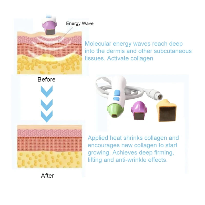 3 in 1 Skin Care Facial Lifting Fractional Skin Tightening Machine Tighten Beauty Tools Anti Aging Wrinkle Remover Device