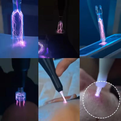 10 in 1 Cool Plasma Beauty Device Ozone Plasma Skin Rejuvenation Wrinkle Removal Anti-aging Machine