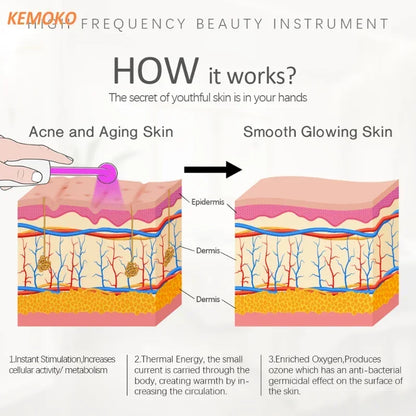 High Frequency Electrode Wand With 4 PCS Neon Electrotherapy Glass Tube Acne Spot Facial Skin Care Spa Violet Ray Wand Face Lift