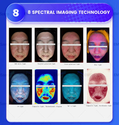 15.6 inch New 3D Facial Skin Analyzer Machine Skin Analyzer Facial Machine 8 Light Spectrum Skin Analysis Scanner