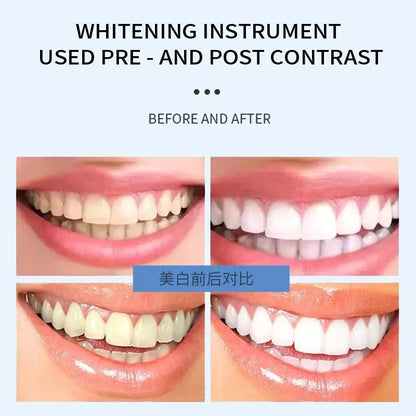 80w Dental Teeth Whitening Accelerator Three Color Led Light 240-300MW/cm² Teeth Whitening Bleaching Dental Professional Lamp