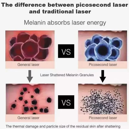 2025 New ND YAG Picosecond Laser Eyebrow Washing Freckle Remover Skin Rejuvenation Face Whitening Tattoo Cleaning Beauty Machine