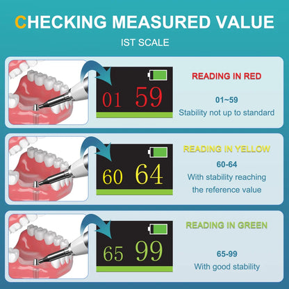 AI-ICHECK Dental Implant Stability Meter IST Test Measuring Device 0°~30° Upward Smart Tapping Strength 1.0N To 1.3N