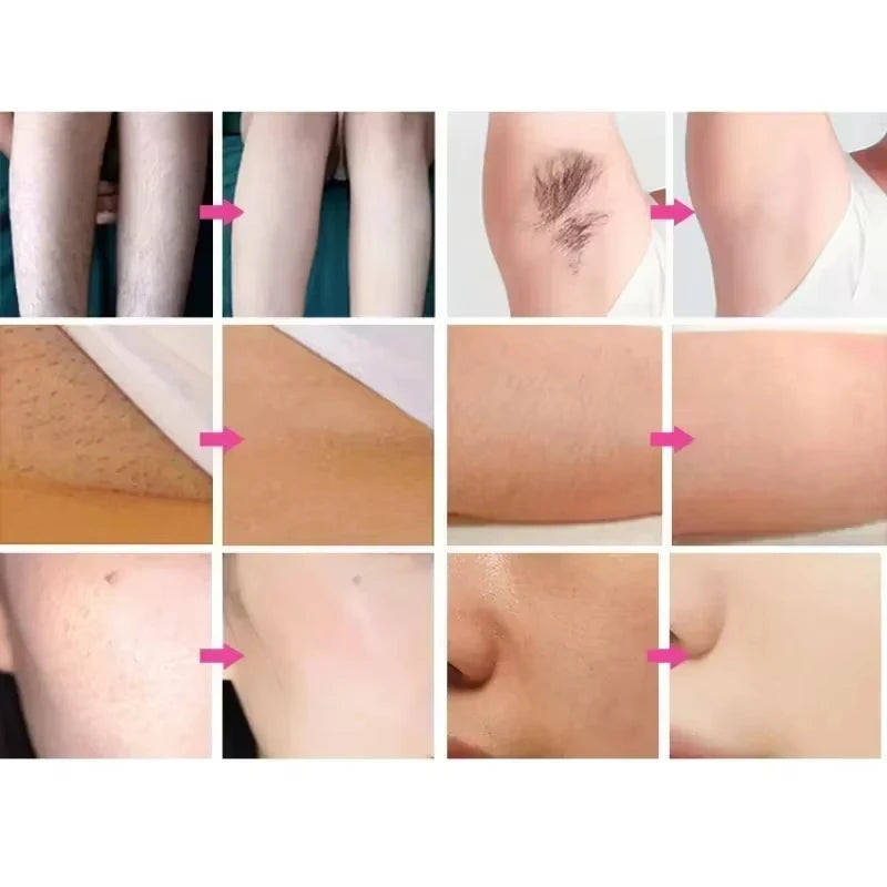 Diode Laser Hair Removal Painless Professional Machine HIGH quality 3 Wavelengths desktop Skin rejuvenation Hair Removal