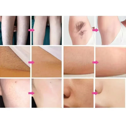 Diode Laser Hair Removal Painless Professional Machine HIGH quality 3 Wavelengths desktop Skin rejuvenation Hair Removal