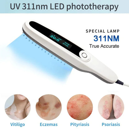 311NM  UVB Narrow Band UV Light Source Treatment Vitiligo Psoriasis Eczema Therapy Lamp Ultraviolet Phototherapy Instrument