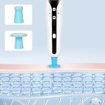 Professional 2 in 1 Plasma Pen Ozone Anti Acne Pen Sterilize Acen Skin Spot Remover Face Lifting Skin Eyelid Lift Mole Removal