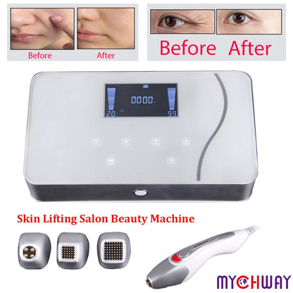 mychway 2025 new Intelligent Fractional RF Machine With Dot Matrix For Skin Rejuvenation Tighten