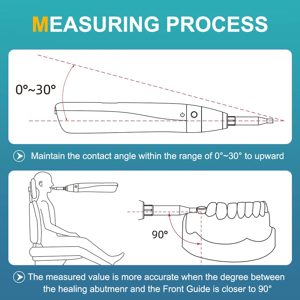 AI-ICHECK Dental Implant Stability Meter IST Test Measuring Device 0°~30° Upward Smart Tapping Strength 1.0N To 1.3N